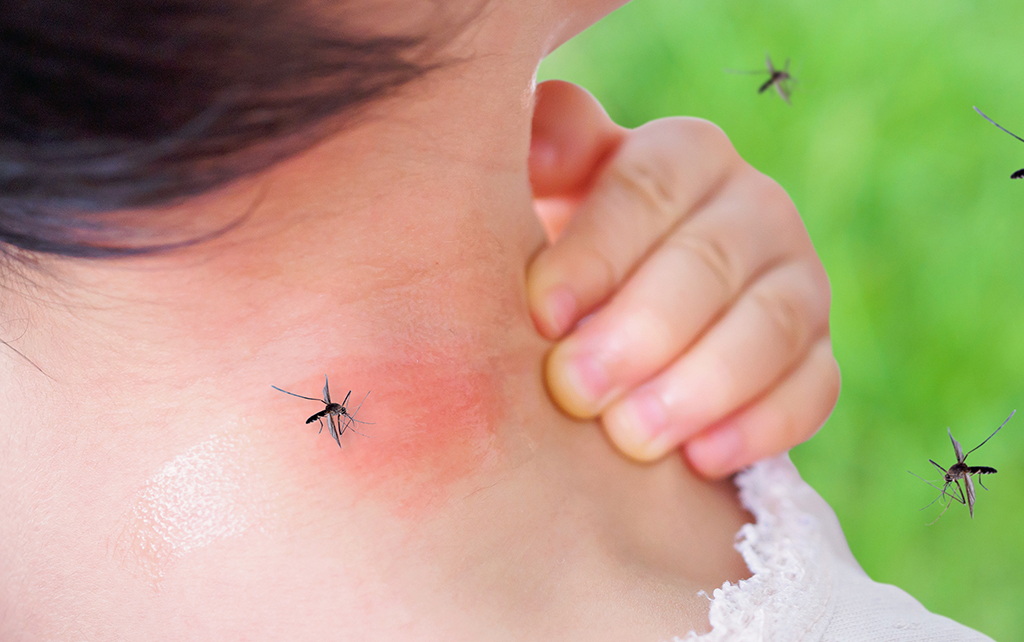 How to avoid mosquito bites on a Tanzania safari?